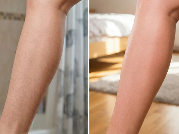 "The regrowth is barely there!"