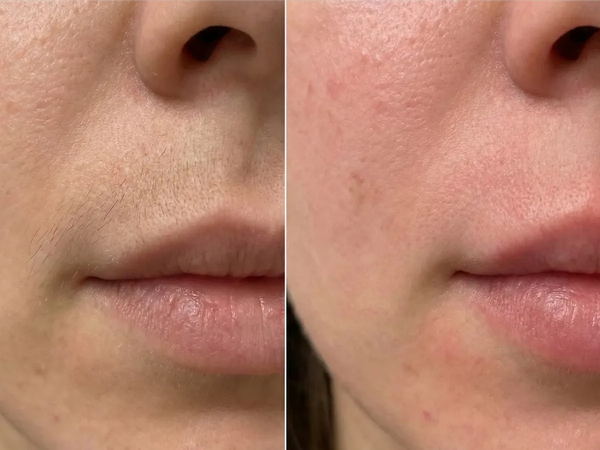 "No more waxing my lip"