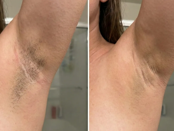 "No more dark shadows"